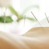 Lutter contre l’insomnie par l’acupuncture