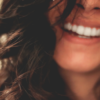9 astuces contre les dents jaunes