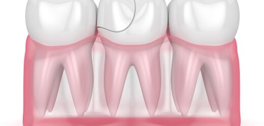 Dents cassées : causes et traitements courants